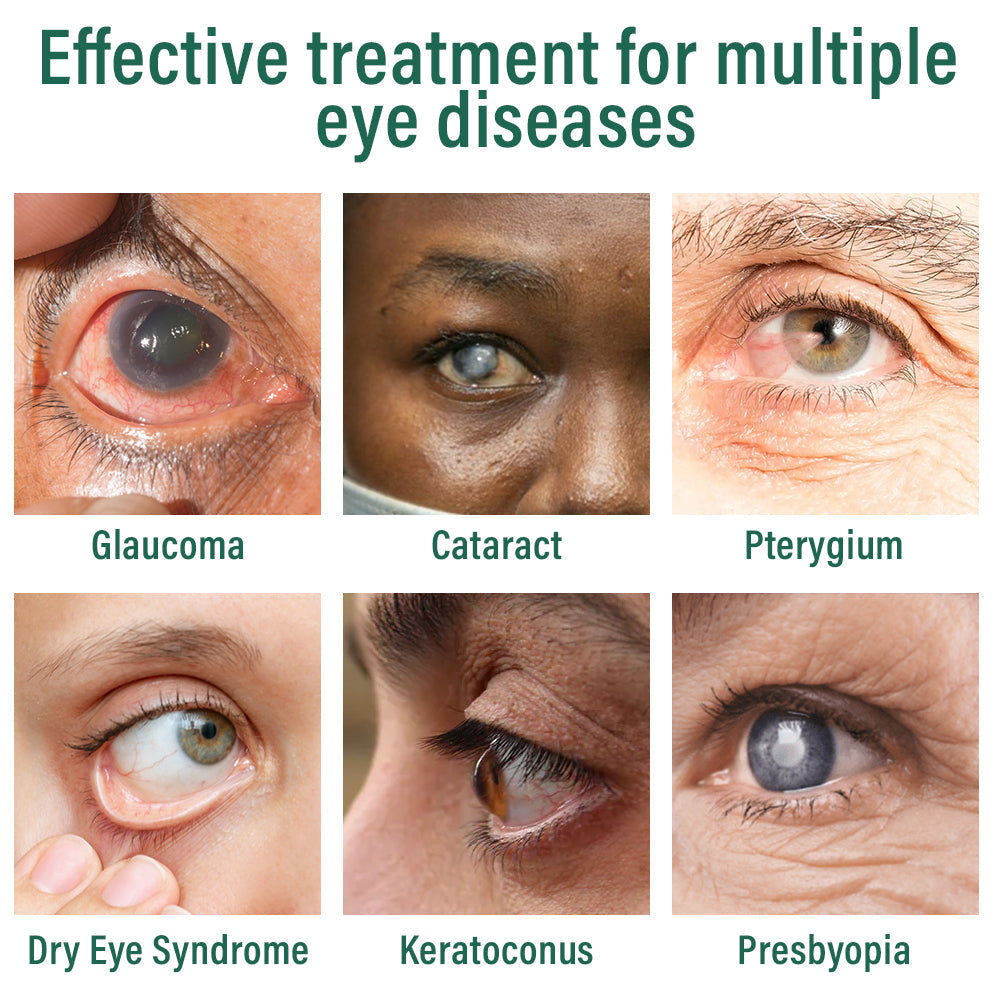 đŠââď¸Nepharn⢠Nano Eye Drops Serum â
FDA Approved(Suitable for presbyopia, dry eye syndrome, glaucoma, and cataracts) đť
