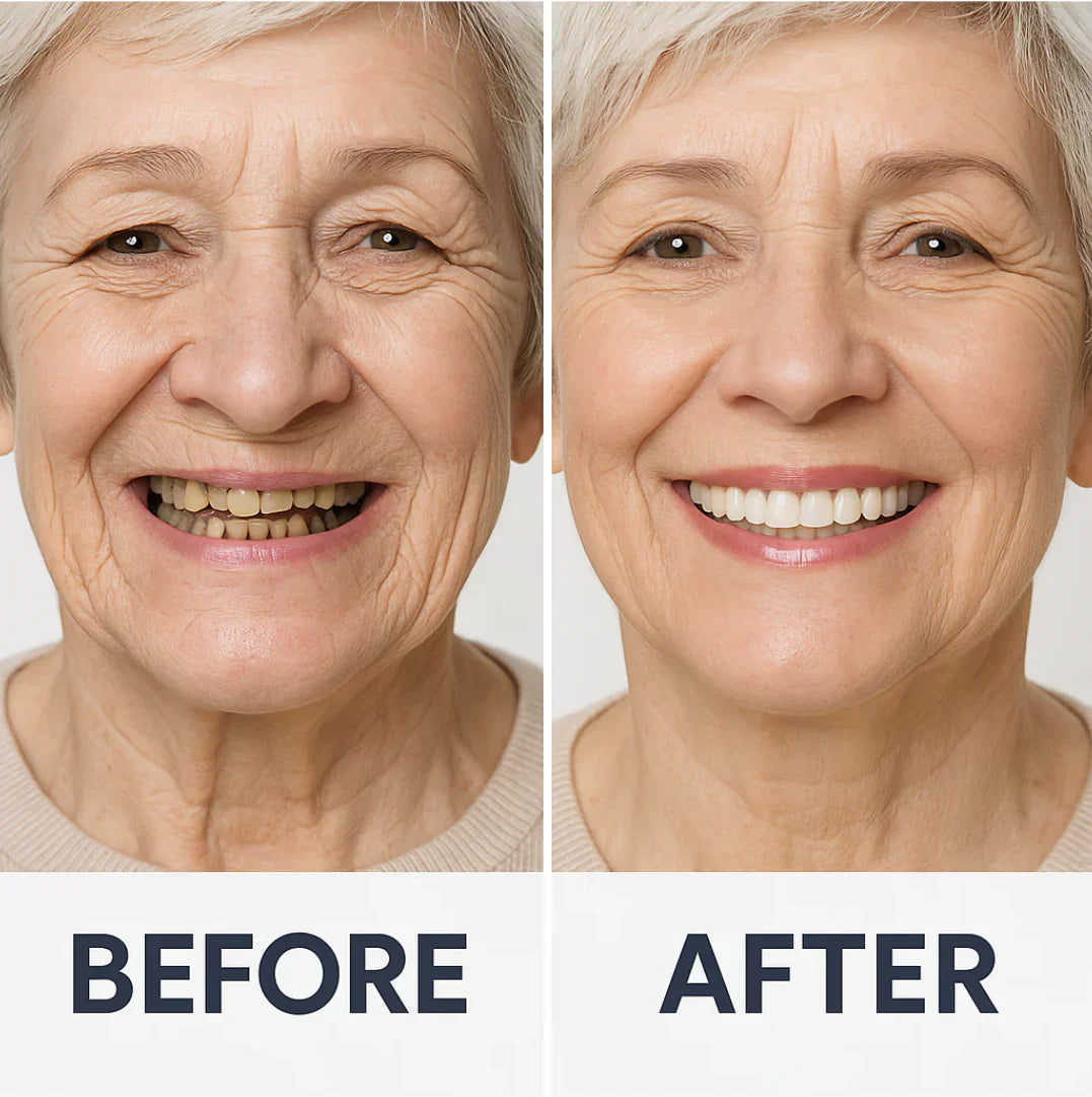 𦷠Nepharn⢠Custom-Fit Functional Dentures š Smile with Confidence