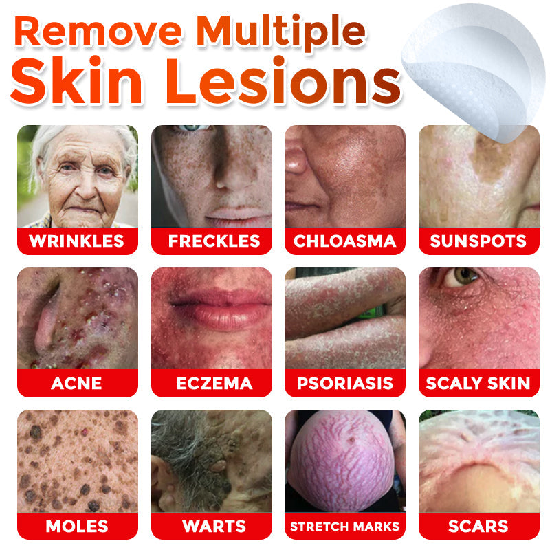 🌈Nepharn™ MicroNeedle Botanic Skin Tag Removal Patch 🇺🇸 Made in the USA
