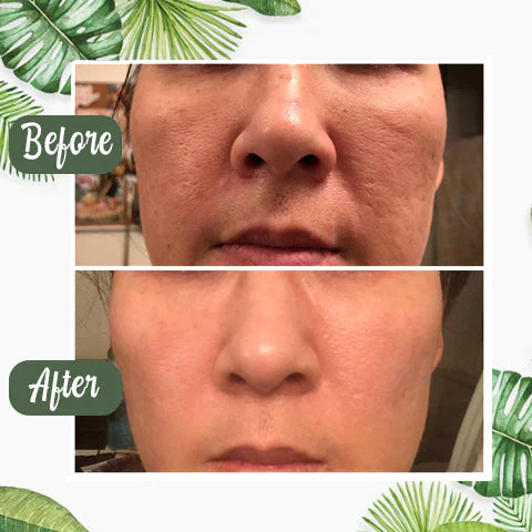 Final Sale - Green Tea Deep Cleanse Mask - (Limited time discount 🔥 last day)