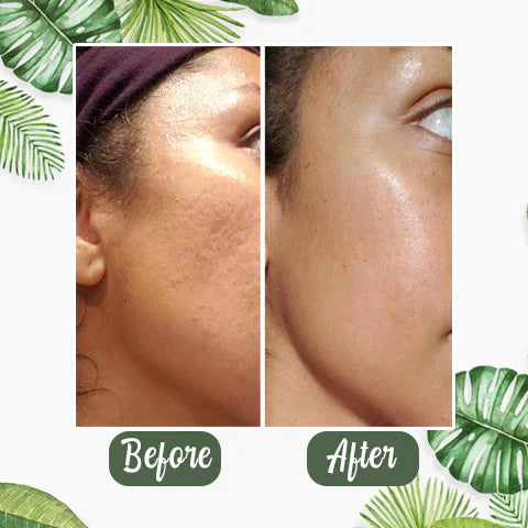 Final Sale - Green Tea Deep Cleanse Mask - (Limited time discount 🔥 last day)