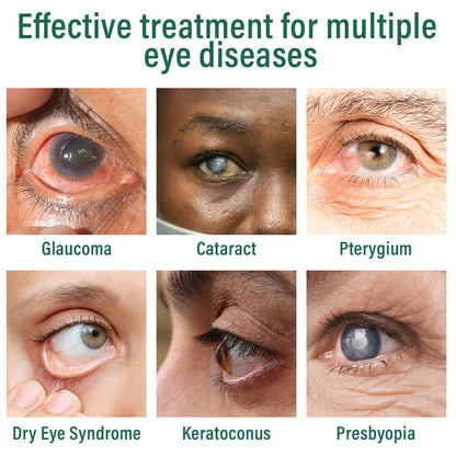 👩‍⚕️Nepharn™ Nano Eye Drops Serum ✅FDA Approved(Suitable for presbyopia, dry eye syndrome, glaucoma, and cataracts) 🌻