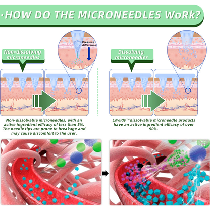 Nepharn™  SMGT Nano Microneedle Patch（Painless, long-lasting, addressing diabetes, obesity, and cardiovascular diseases）